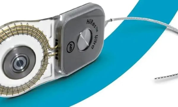 AB 人工耳蜗又一创新植入体 —— HiRes™ Ultra 在中国大陆上市