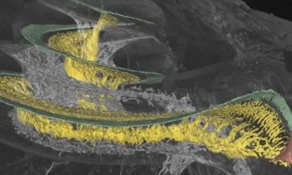 文献摘译｜人工耳蜗听觉解密：耳蜗螺旋神经节细胞的分布特征