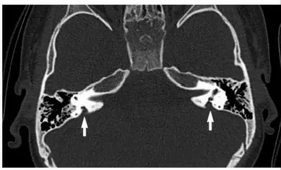 An image to describe post