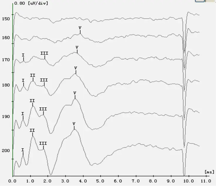 An image to describe post
