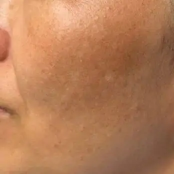 An image to describe post