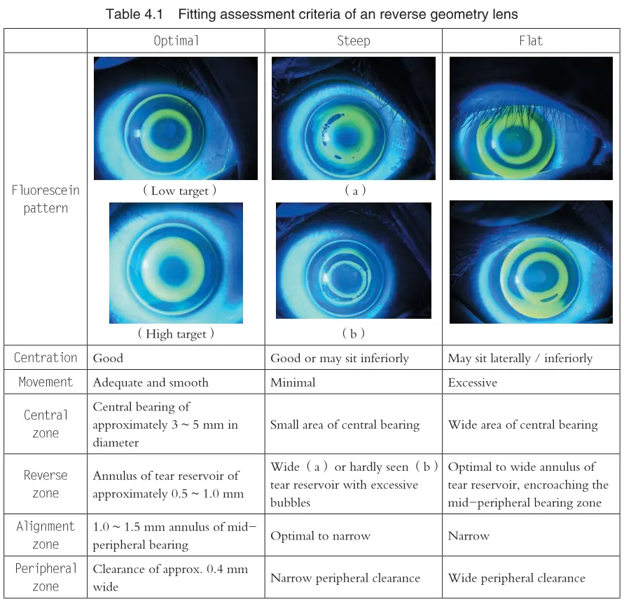 An image to describe post How to design the Simplest OrthoK lens with Wolfram Language(5)