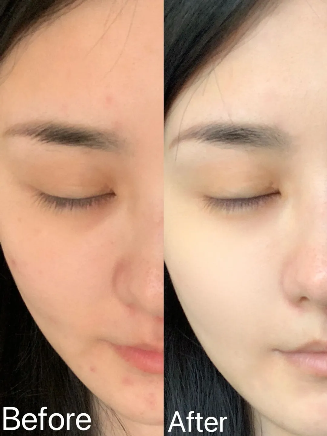 An image to describe post