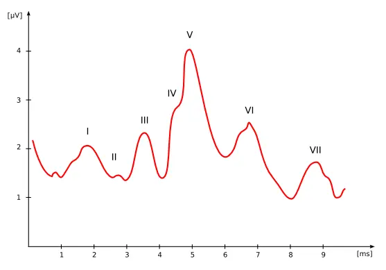 An image to describe post
