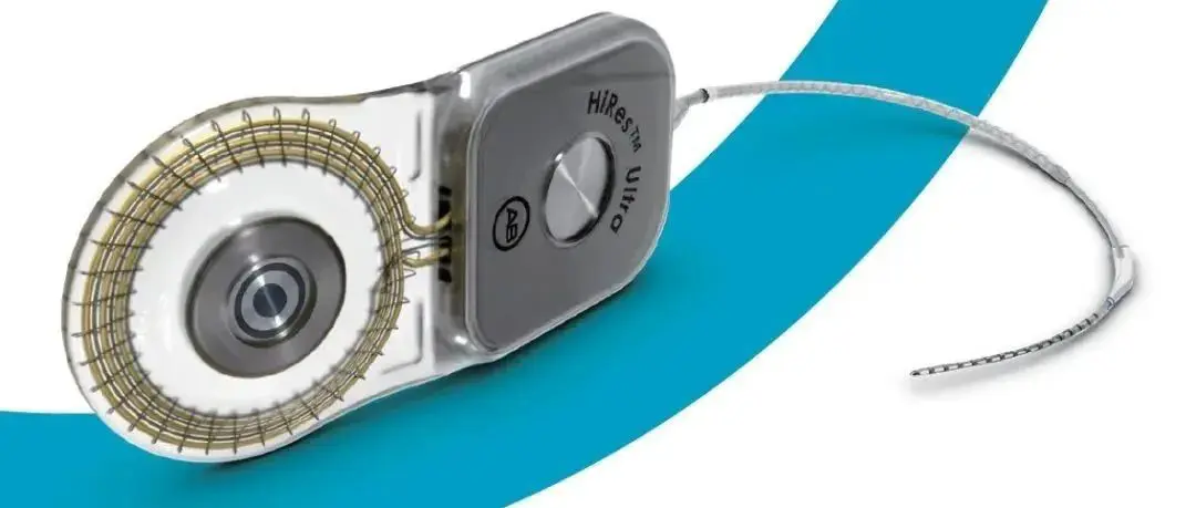 AB 人工耳蜗又一创新植入体 —— HiRes™ Ultra 在中国大陆上市
