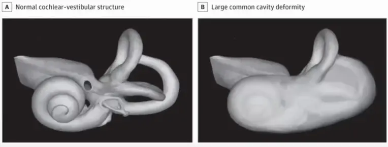 An image to describe post