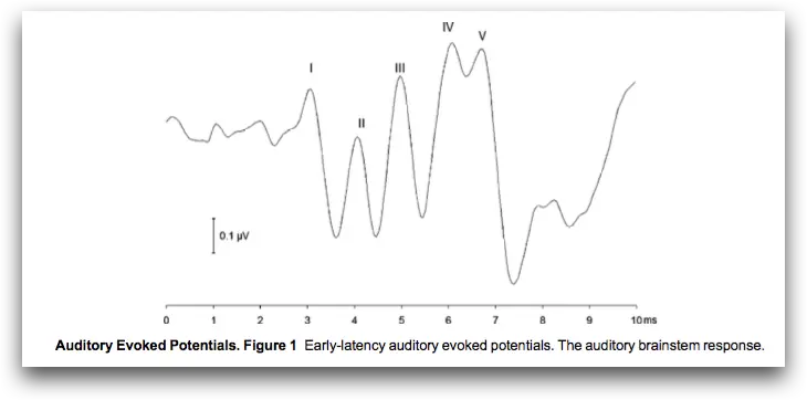 An image to describe post
