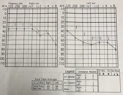 An image to describe post