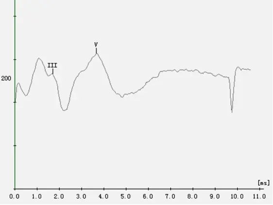 An image to describe post