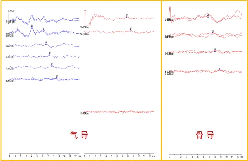 An image to describe post