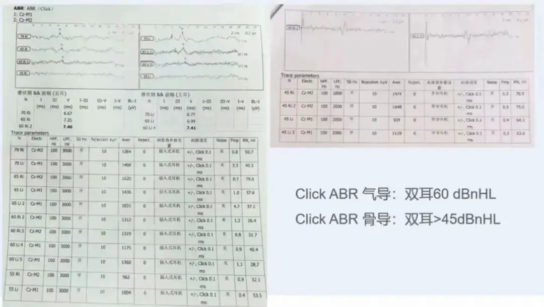 An image to describe post