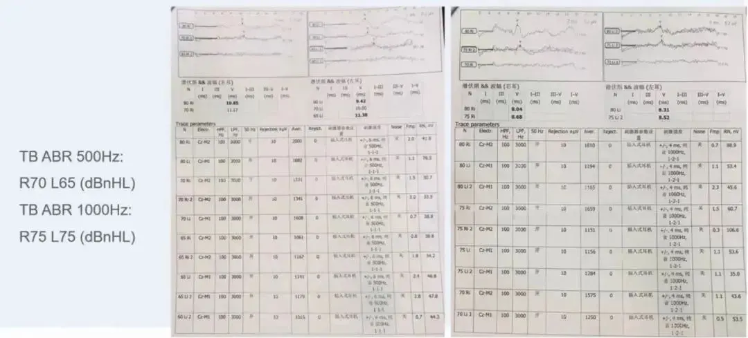 An image to describe post