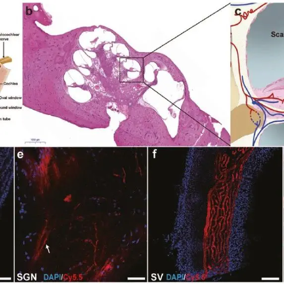 STTT | 突破！影响全球15亿人的内耳疾病治疗或许迎来新的变革，杨仕明/林坚/钟武发现一种打开血迷路屏障的新靶点