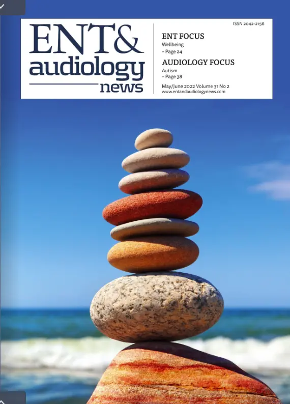 An image to describe post