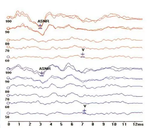 An image to describe post