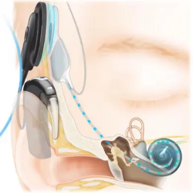 An image to describe post