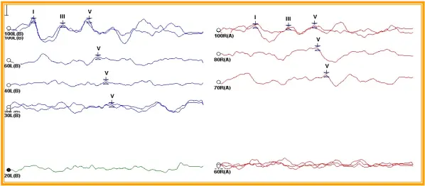 An image to describe post