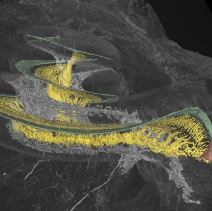 文献摘译｜人工耳蜗听觉解密：耳蜗螺旋神经节细胞的分布特征