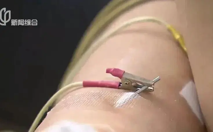 An image to describe post