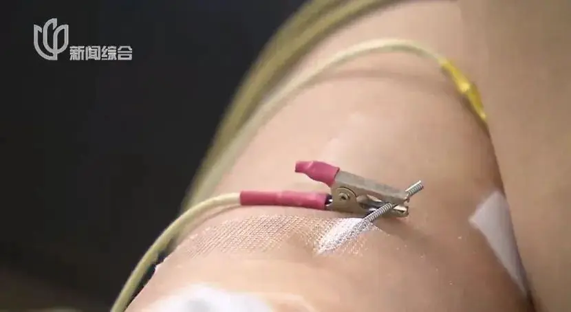 An image to describe post