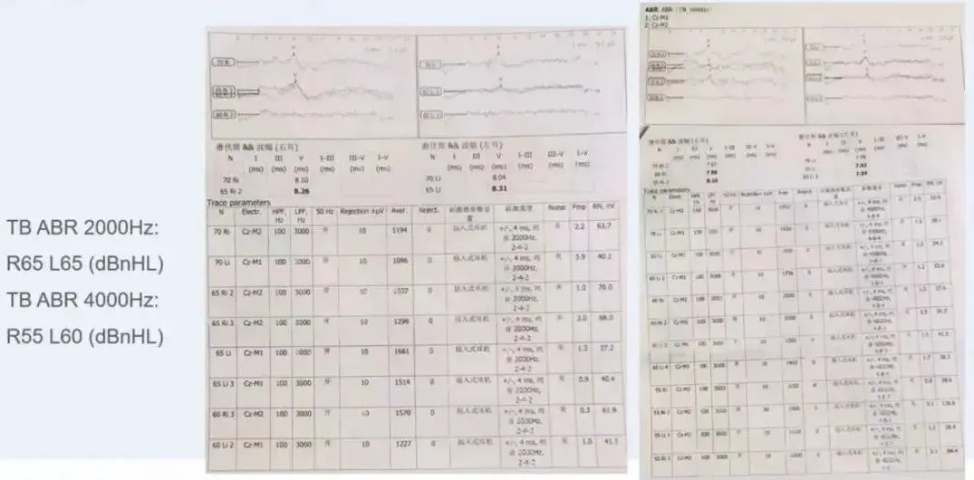 An image to describe post