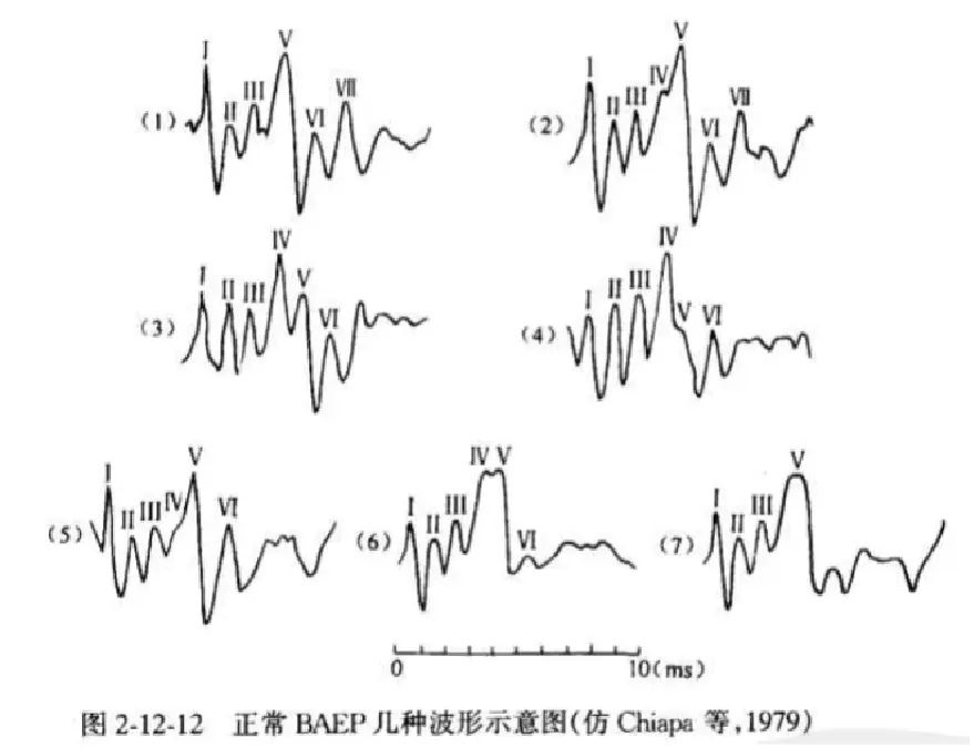 An image to describe post