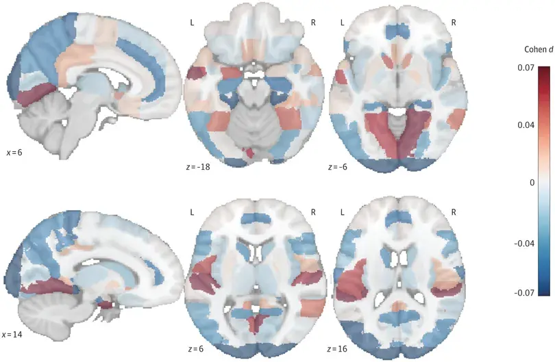 An image to describe post
