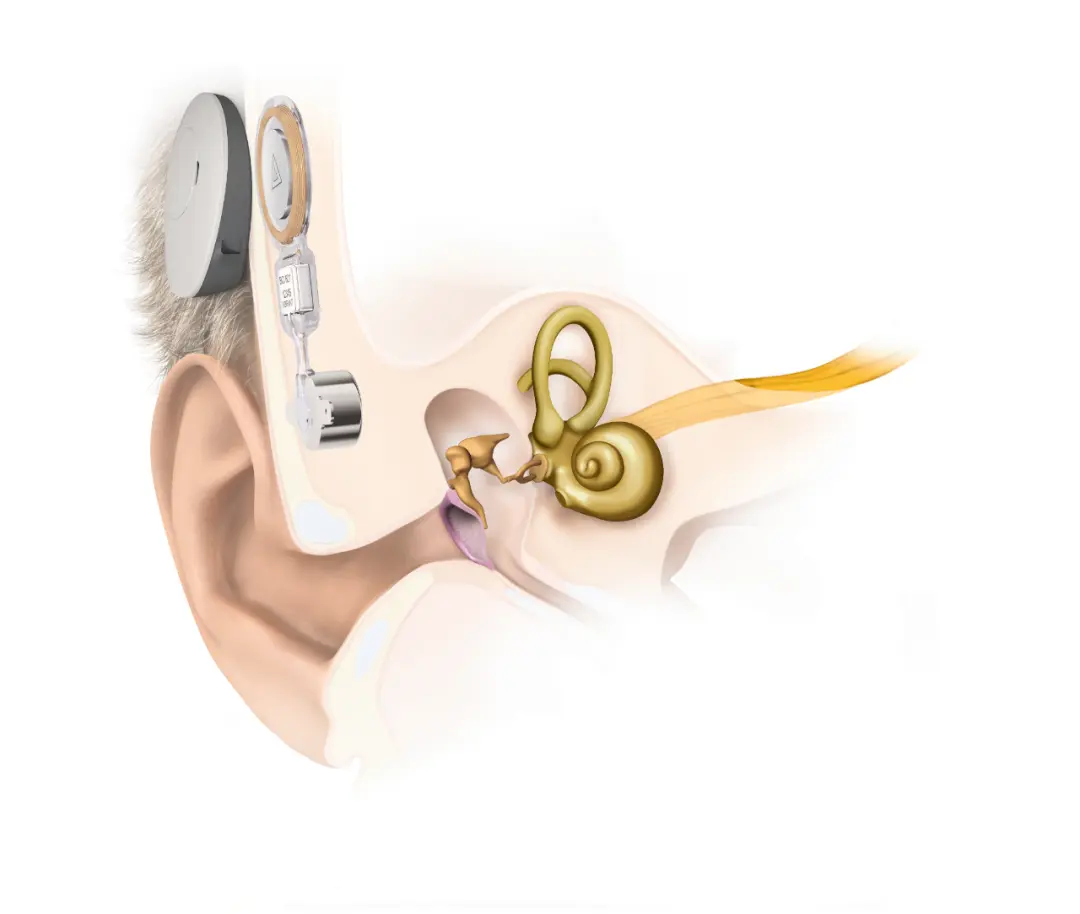 An image to describe post