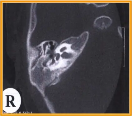 An image to describe post