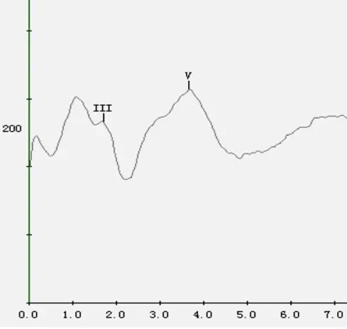 An image to describe post