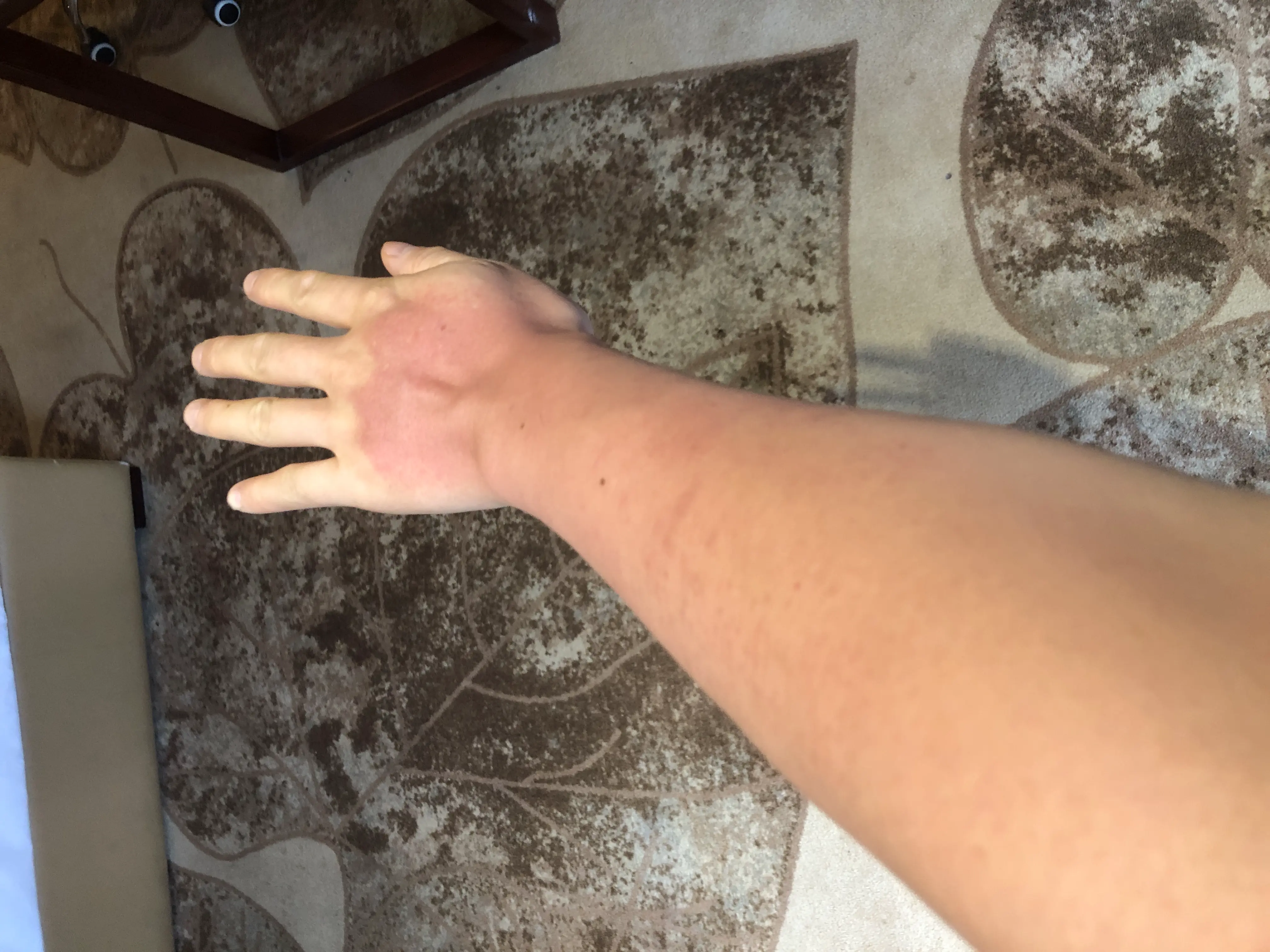 An image to describe post