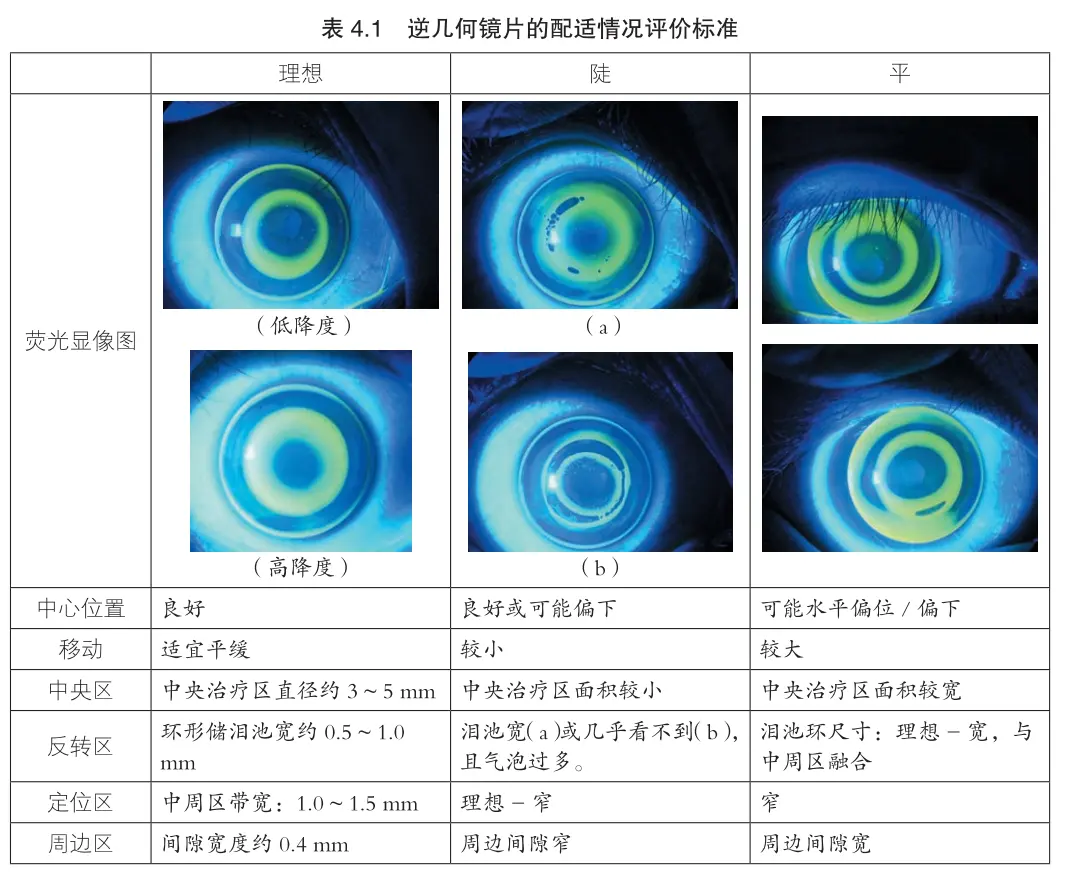 An image to describe post 如何用wolfram语言设计一枚最简单的角膜塑形镜(5)