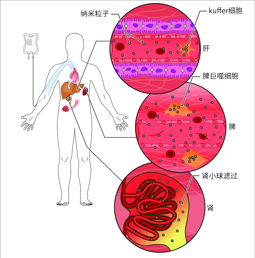 An image to describe post 霸道总裁整夜输液，有这个必要吗？