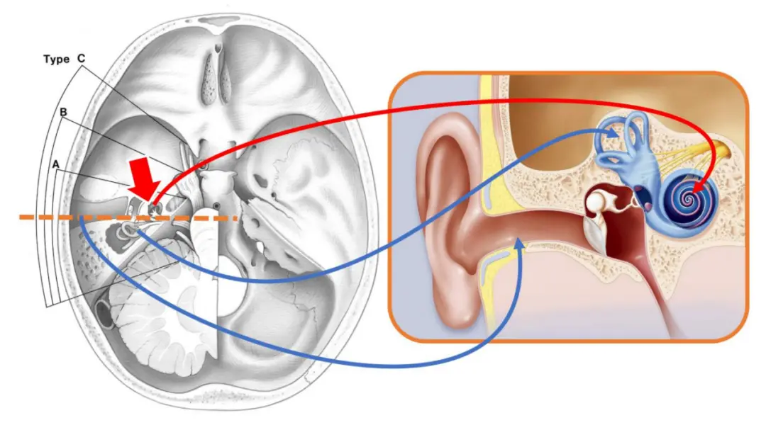 An image to describe post