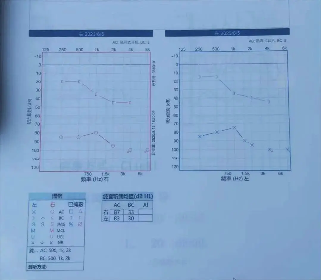 An image to describe post