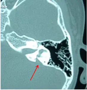 An image to describe post