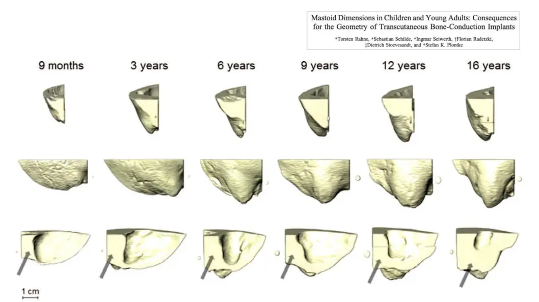 An image to describe post