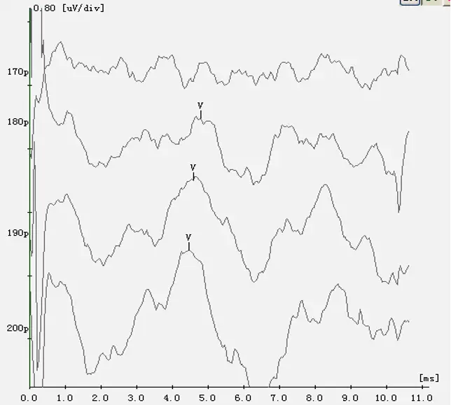 An image to describe post