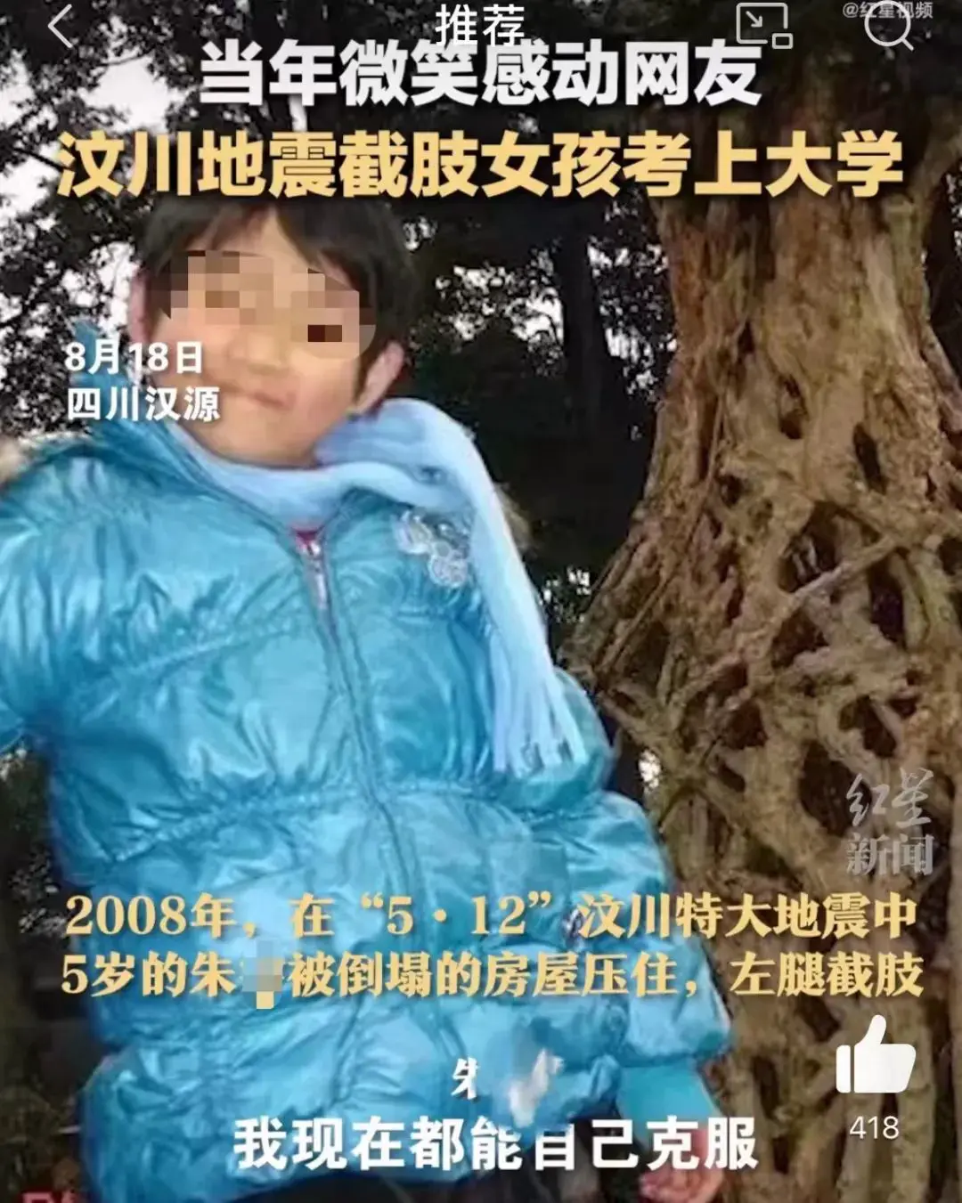 An image to describe post 汶川地震截肢女孩考上中医药大学，想帮助更多人……